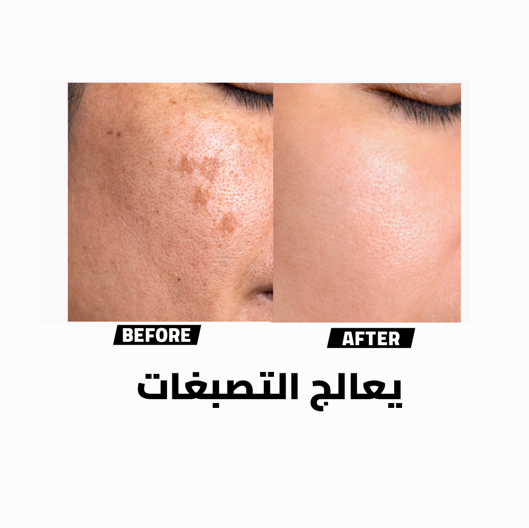 JSKIN HACKS Jolie Pharma