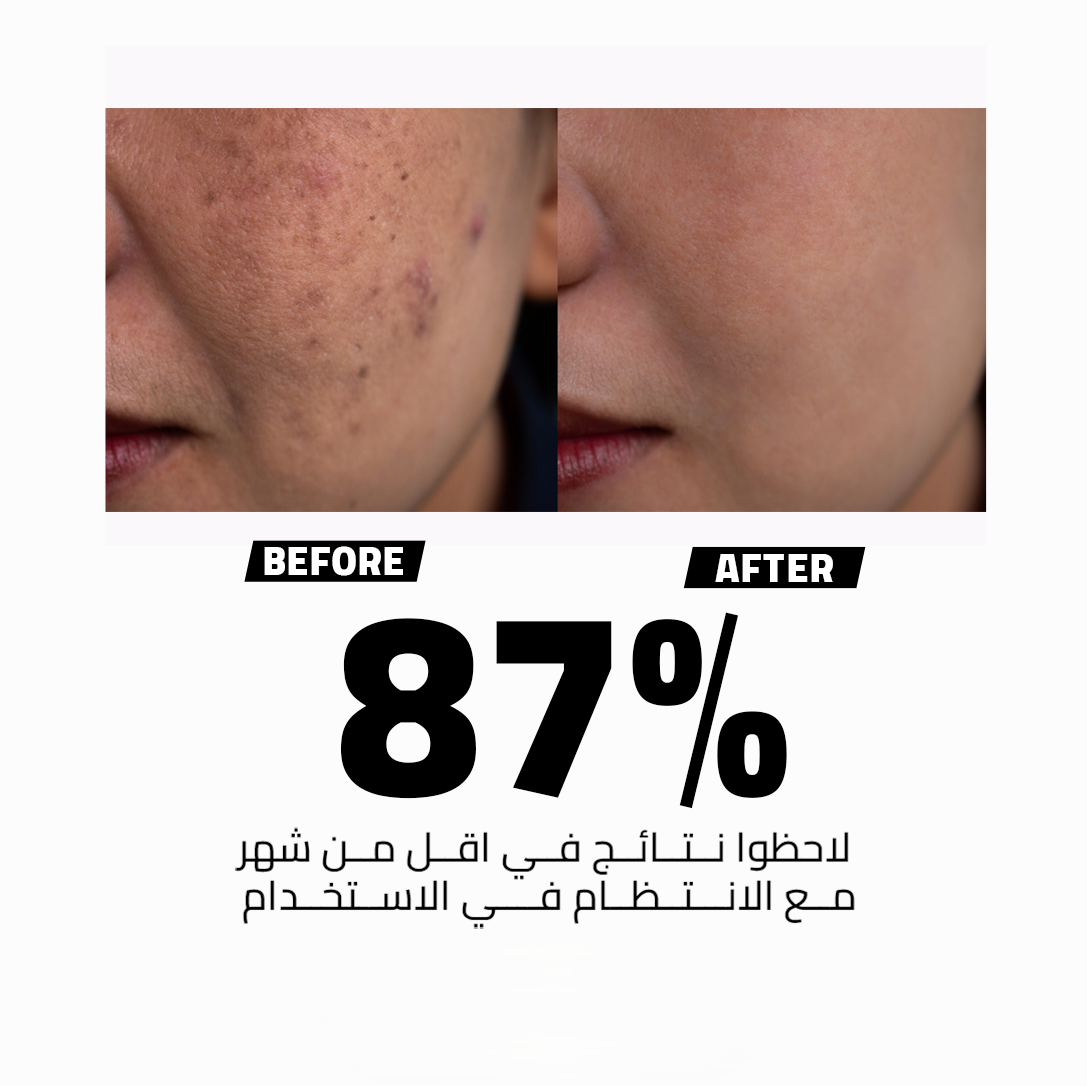 JSKIN HACKS Jolie Pharma